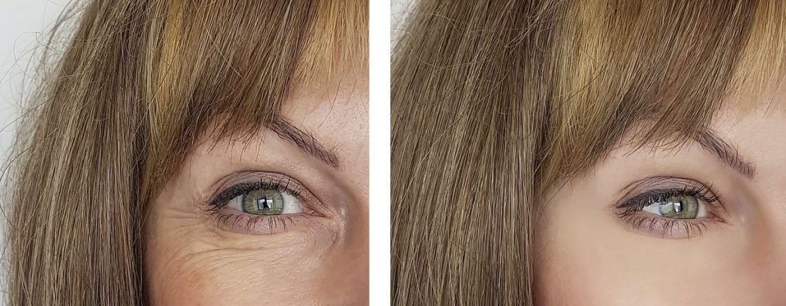 Signs of Eye Aging and by dulce Bonito cosmetcs